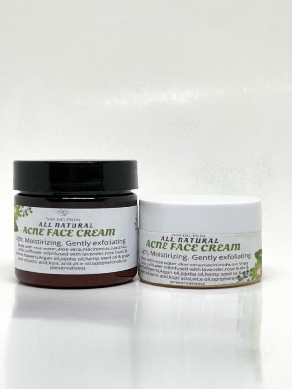 All Natural Face Cream|Acne Prone Skin|Camwood|Oat|Niacinimide|Lactic AcidVegan